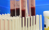 Assay for 20 ml blood sample vials